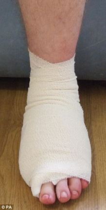foot with bandage on it